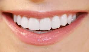 branqueamento dental min