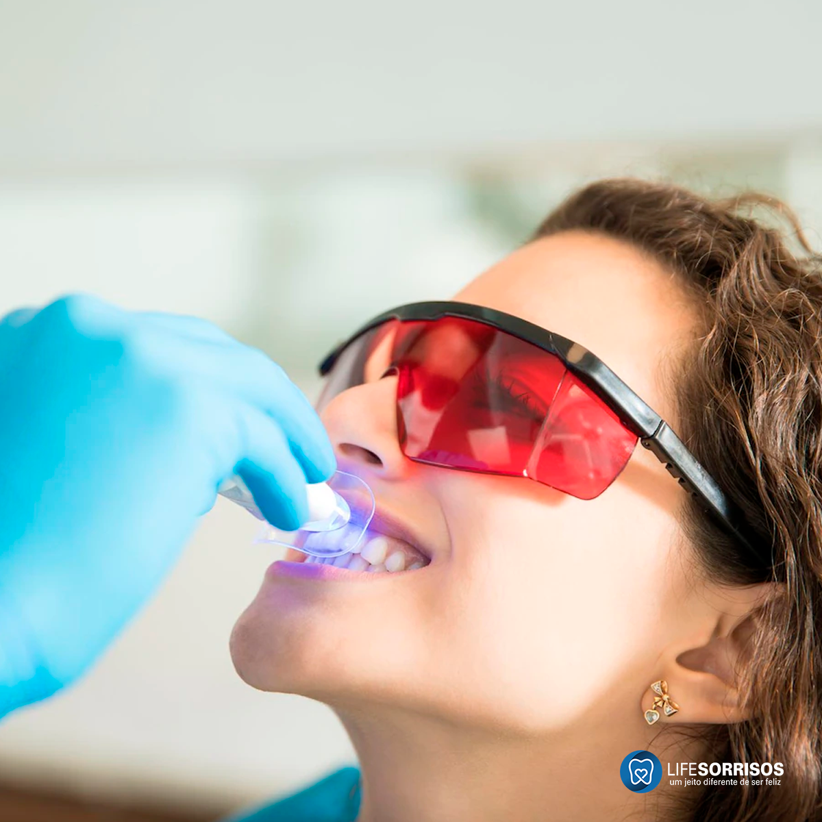 clareamento dentário enfraquece os dentes