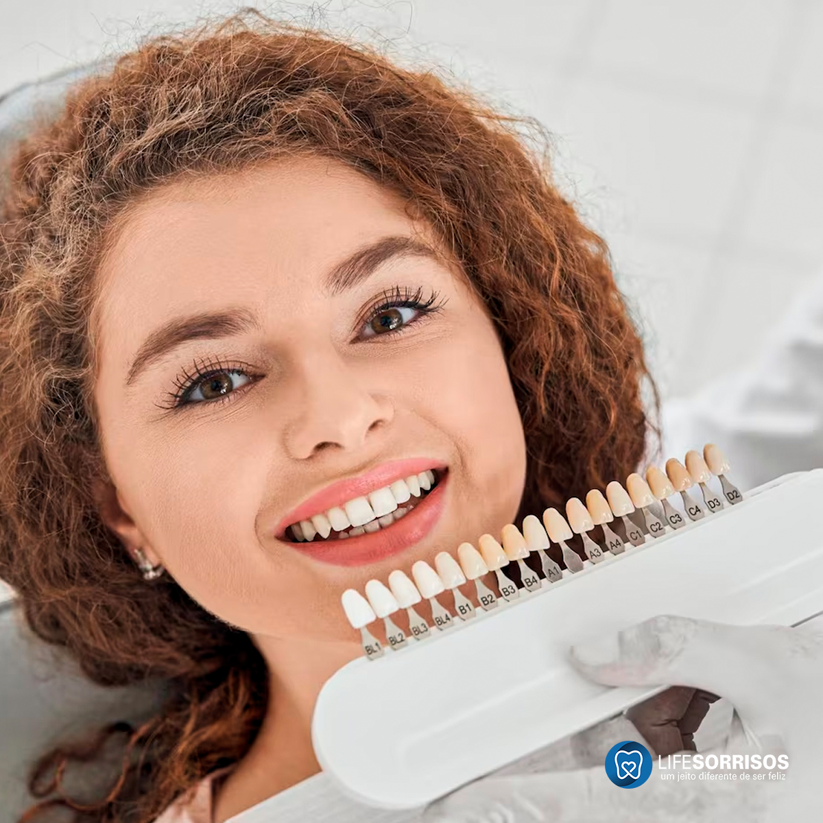 como é a manutenção da faceta, precisa ir todo mês ao dentista