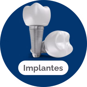 implantes