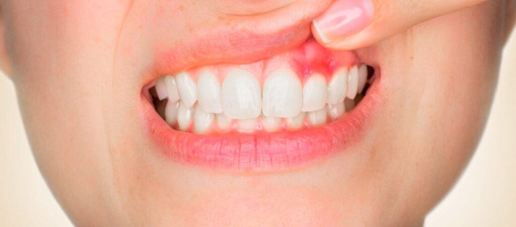 periodontia min