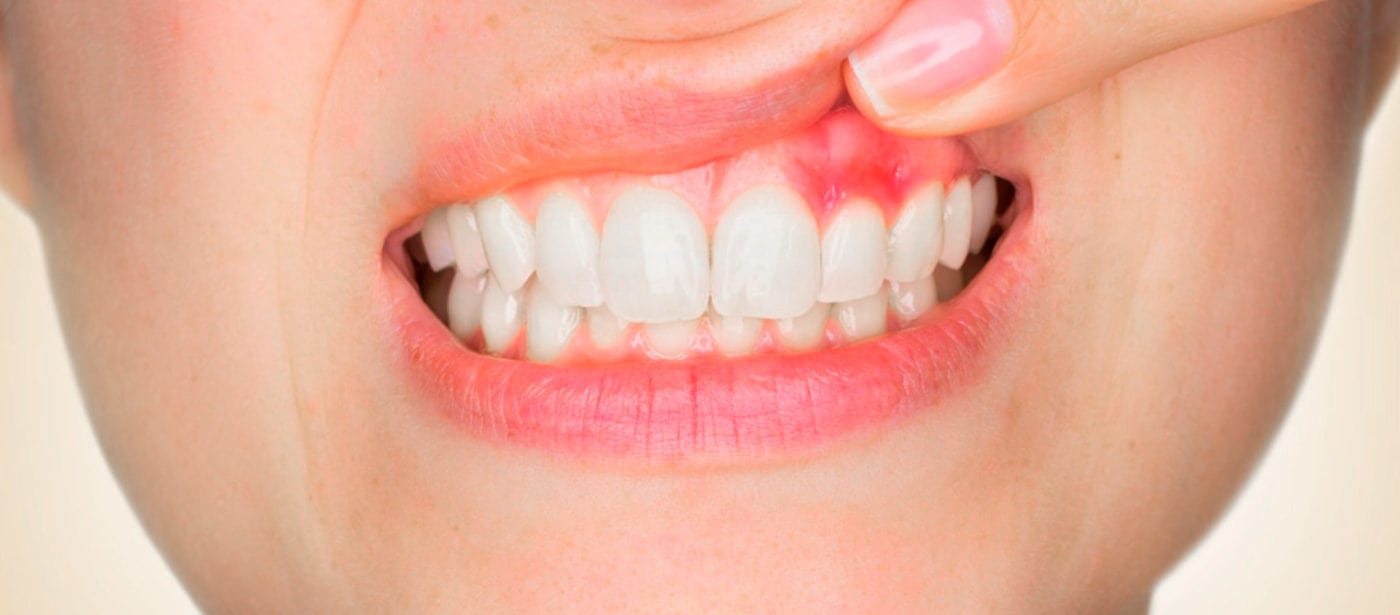 periodontia min