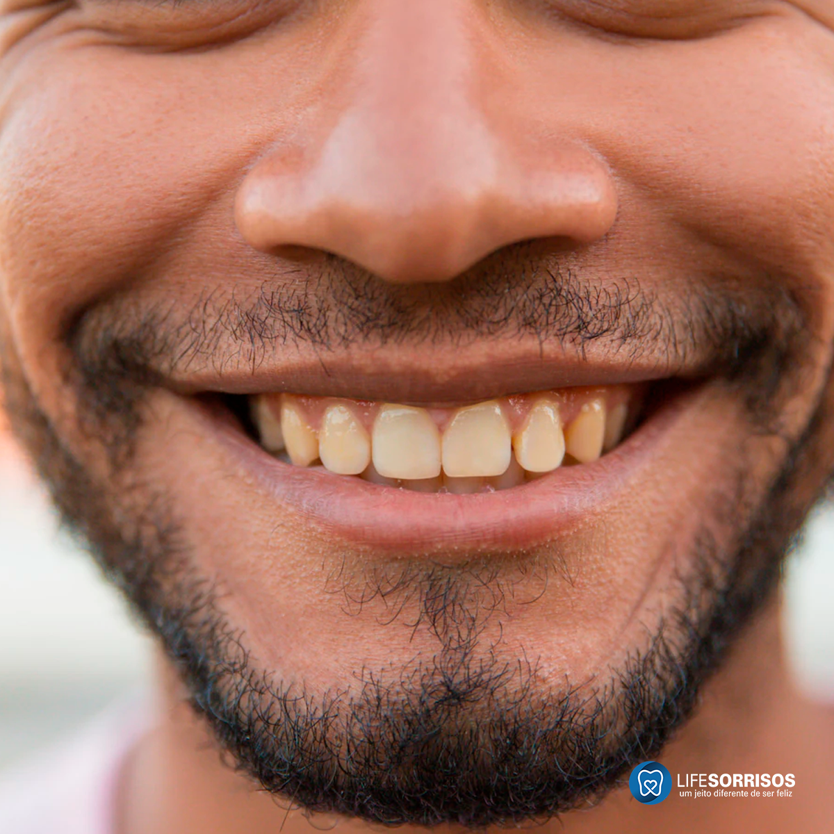por que os dentes escurecem