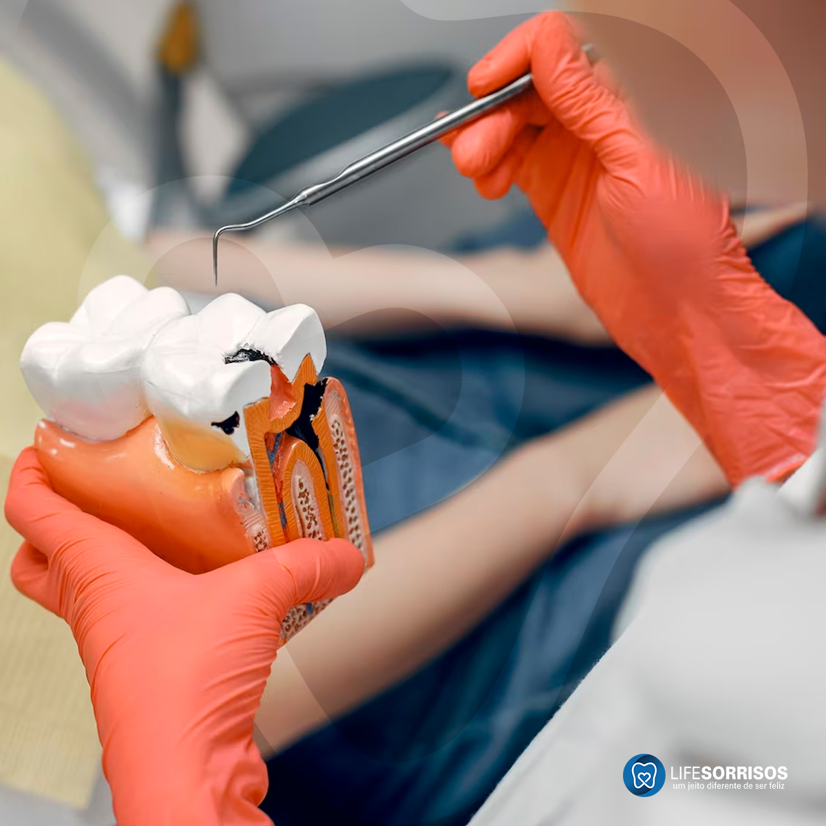 quando é preciso extrair um dente
