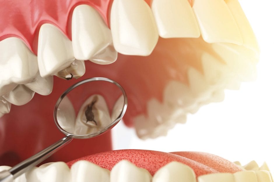 restauracao osasco sp life sorrisos dentista min