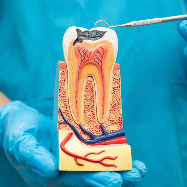 canal endodontia