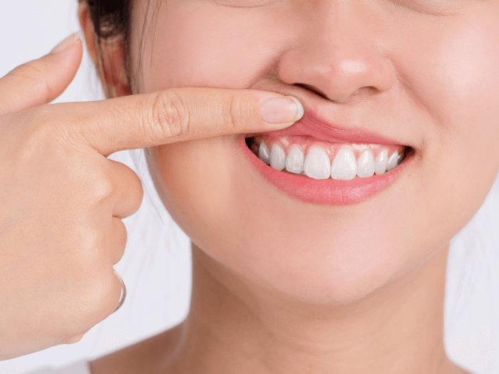 periodontia 1 700x525